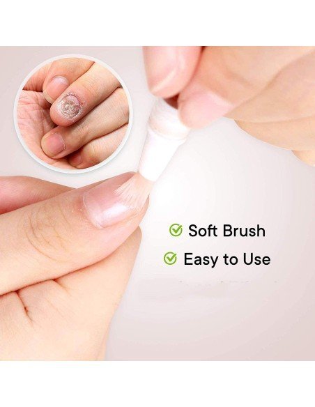 Lápiz Reparador de Uñas elimina Hongos Fungus  !! Lápiz Reparador de Uñas elimina Hongos Fungus  !!