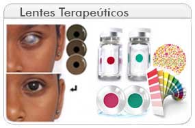 Lentes de Contacto Terapeuticos