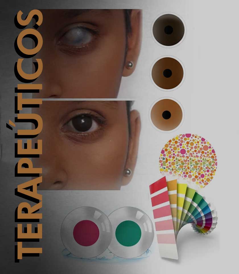 Lentes de Contacto Terape&uacute;ticos